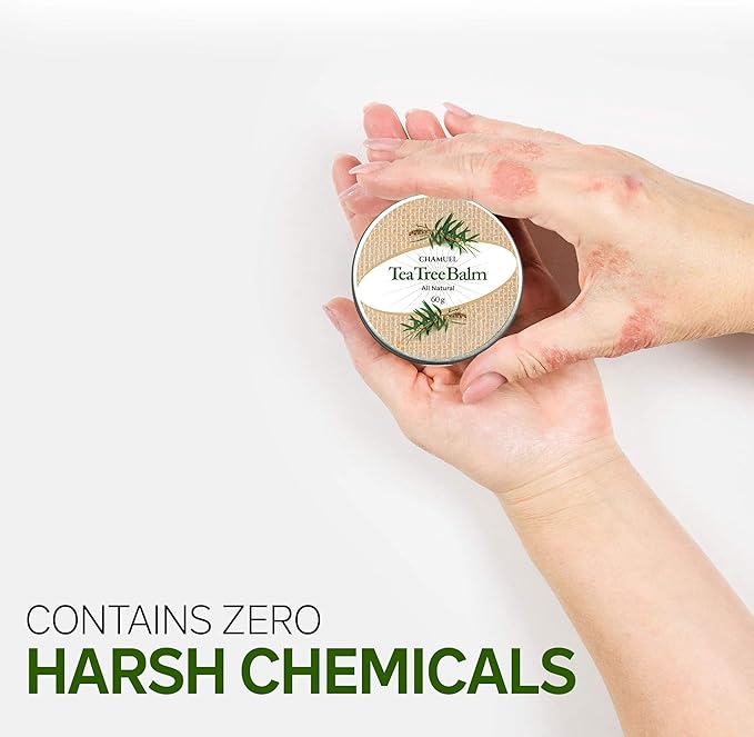 Tea Tree Oil Balm - All Natural | Great Cream for Soothing Eczema, Psoriasis, Rashes, Jock Itch, Insect Bites, Folliculitis, Acne, Itches, Cracked Heels, Cuticles, Saddle Sores & more!