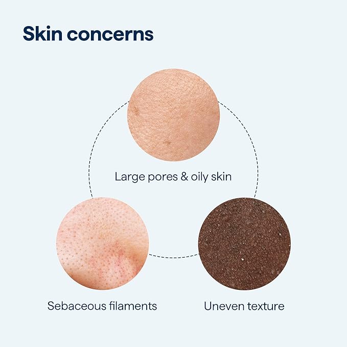 Remedy for Pore Size – Large Pore Minimizer with Retinol, BHA Salicylic Acid, Niacinamide – for Uneven Texture, Pimples, Blackheads, Whiteheads, Sebaceous Filaments – by Dermatologist Dr. Shah