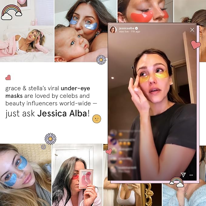 grace & stella Under Eye Patches (12 pairs) Eye Masks for Dark Circles and Puffiness - Stocking Stuffers for Women, Christmas Gifts, Birthday Gifts, Bachelorette Party Favors, Bridesmaid Proposal Gift