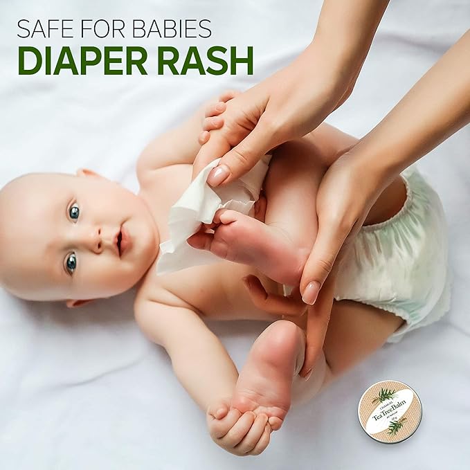 Tea Tree Oil Balm - All Natural | Great Cream for Soothing Eczema, Psoriasis, Rashes, Jock Itch, Insect Bites, Folliculitis, Acne, Itches, Cracked Heels, Cuticles, Saddle Sores & more!