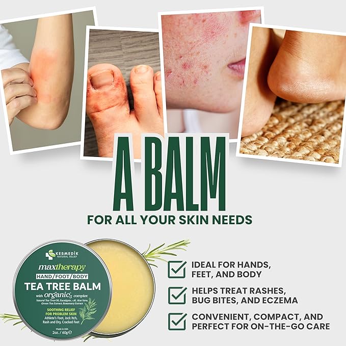 Tea Tree Oil MaxTherapy Balm, Itchy Skin Relief, Soothing for Rashes, Jock Itch, Athlete’s Foot, Chafing, Insect Bites, Folliculitis, Dry Sensitive Skin, Effective & Safe for All Ages, 1-Pack